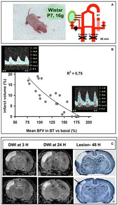 A Model of Perinatal Ischemic Stroke in the Rat: 20 Years Already and What Lessons?
